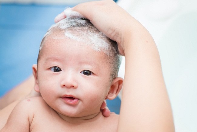 3 Langkah Mudah Menghilangkan Ketombe pada Kulit Kepala Bayi - Alodokter