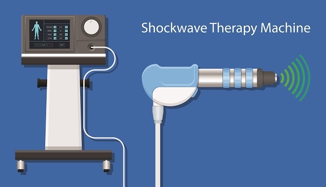 Kenali Apa Itu Extracorporeal Shock Waves for Sexual Therapy (ESST) - Alodokter