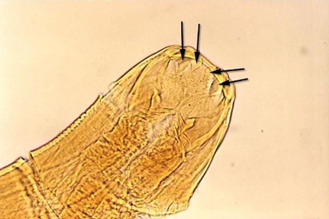 Patofisiologi Ankilostomiasis Alomedika