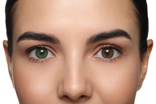 Heterochromia - Gejala, penyebab dan mengobati - Alodokter