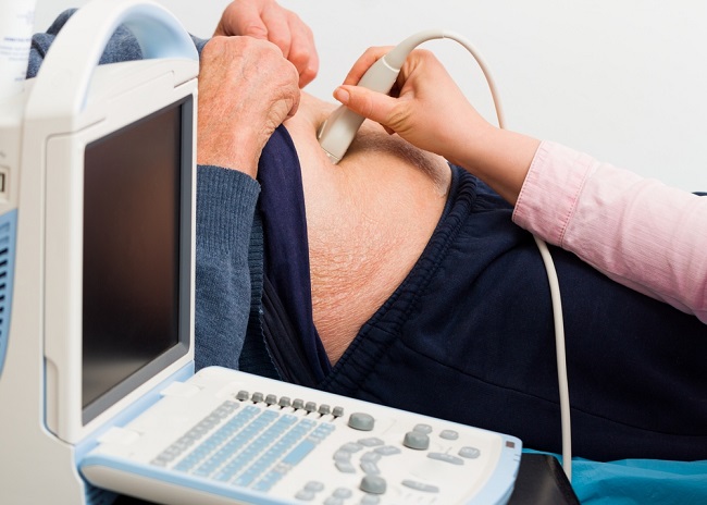 Kenali Apa Itu Pemeriksaan Aneurisma Aorta Abdominal - Alodokter