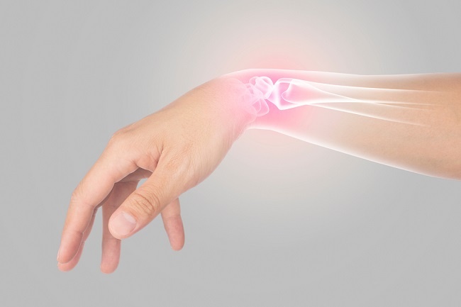Characteristics of Recurring Ulcers and Effective Ways to Overcome Them