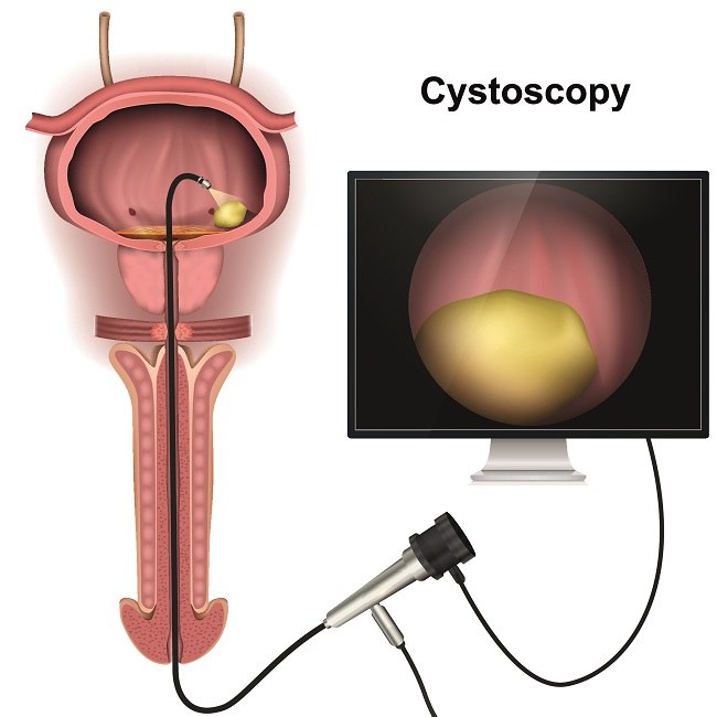 19-asr porno rasmlari