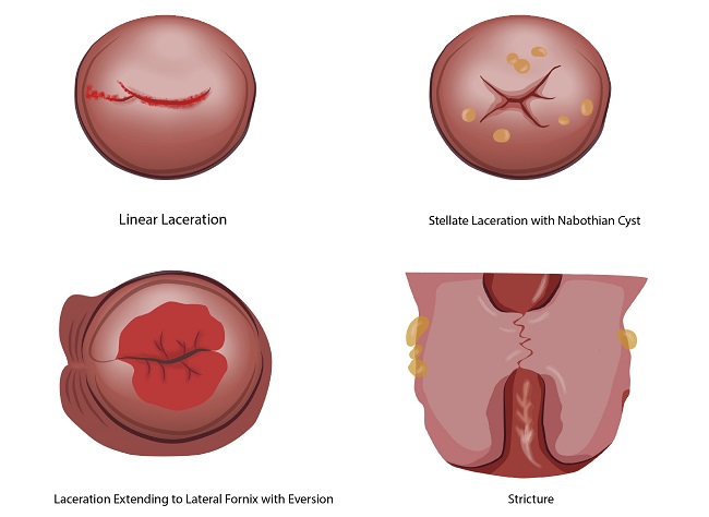 Pamela But fotosurati Kirsten Dunstning yalangoch dumbasi