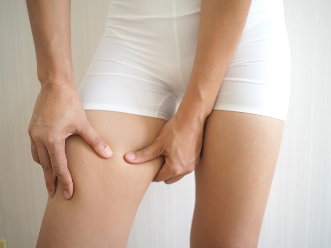 Selangkangan Lecet, Ini Cara Mudah Mengatasinya - Alodokter