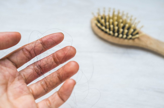 Hormon Rambut 11 Penyebab Rambut Rontok pada Remaja dan Cara Mengatasinya - Alodokter