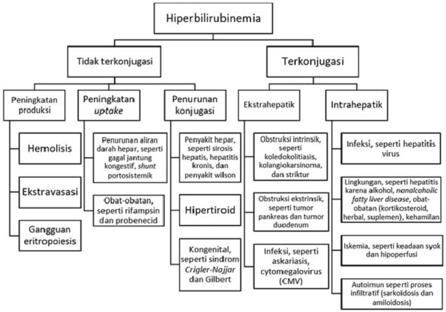 Diagnosis Hiperbilirubinemia Alomedika   Diagnosis 0 Alomedika 