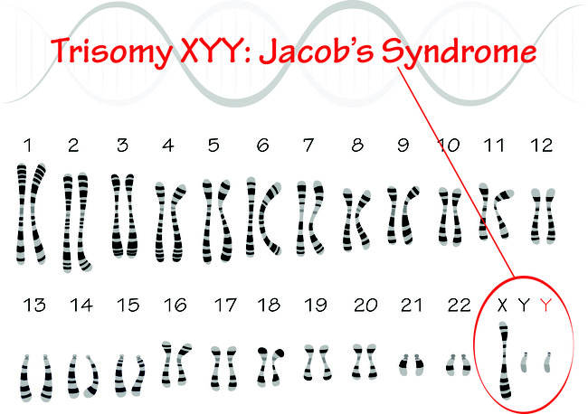 Sindrom Jacob - Alodokter