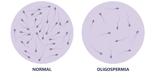 Qullikda onlayn jinsiy aloqa