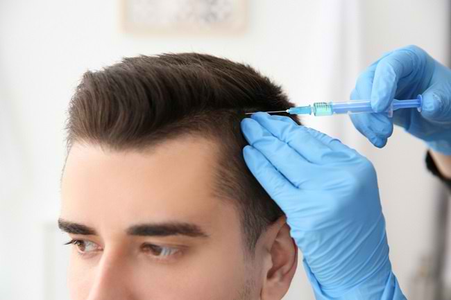 Mengenal Berbagai Prosedur Medis Penumbuh Rambut - Alodokter