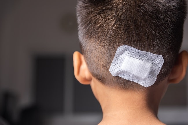 Melatonin pada Anak dengan Gejala Pasca Konkusi-min
