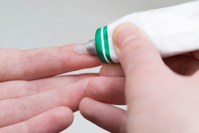6 Merek Obat Hydrocortisone yang Ada di Apotik - Alodokter