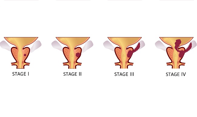 Qurilmalar bilan jinsiy aloqa video