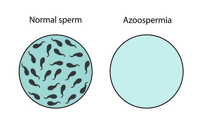 Spermatozoiddagi teshiklar