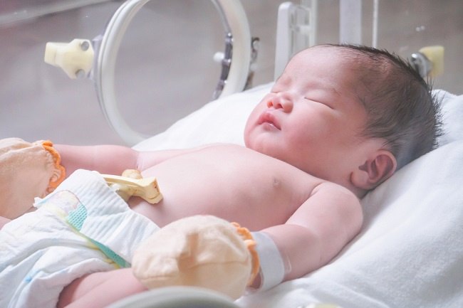 Astagfirullah.. Bayi Lahir dalam Kondisi Usus Terburai Keluar Astagfirullah.. Bayi Lahir dalam Kondisi Usus Terburai Keluar