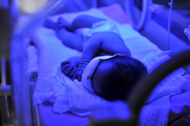 Recognize Newborn Normal Bilirubin Levels
