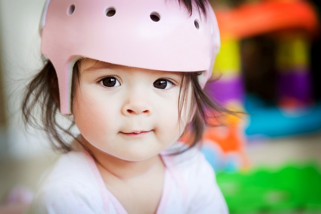 Cranial Helmet, Helm Khusus untuk Kepala Bayi Peyang - Alodokter