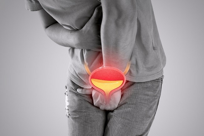 Sindrom Nyeri Kandung Kemih, Peradangan Kronis Penyebab Masalah Buang Air Kecil - Alodokter