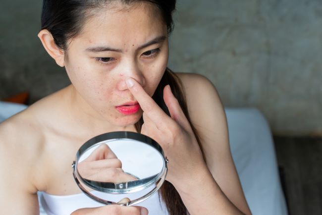 Jerawat Di Dalam Hidung Inilah Penyebab Dan Cara Mengatasinya Alodokter 6483