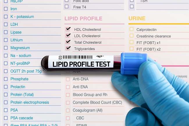 Hiperlipidemia - Alodokter