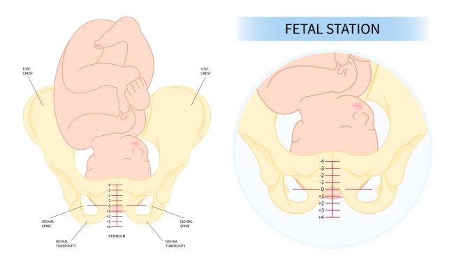 7 Ciri-Ciri Janin Masuk Panggul yang Perlu Diketahui - Alodokter