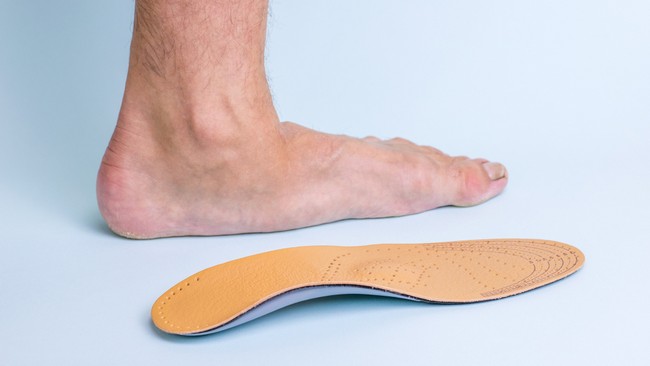 เท้าแบน (Flat Feet) - อาการ, สาเหตุ, การรักษา - Pobpad