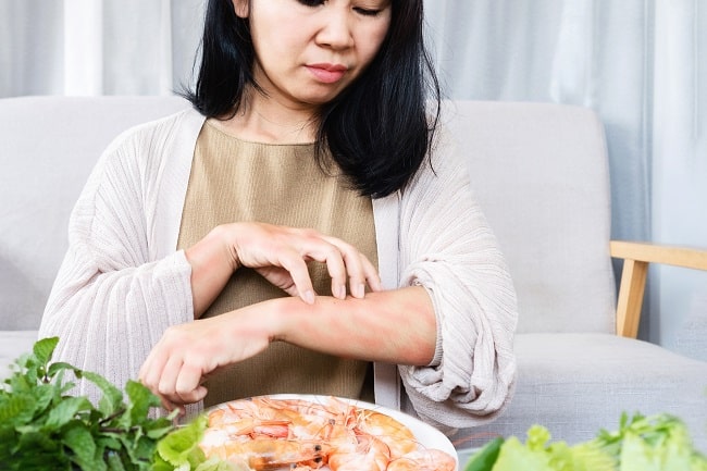 Membedakan Alergi Makanan Dan Intoleransi Makanan Alomedika