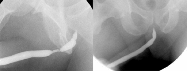 Porno ona suti Orta asrlarda ular qanday sikishgan