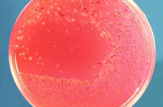 Voyaga etgan ayolning mushuk oqish surati