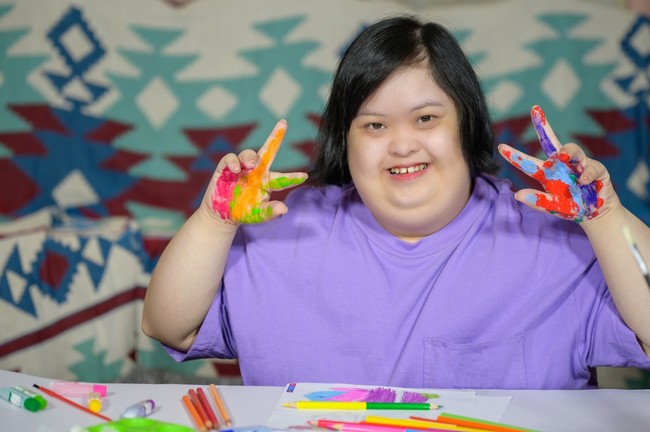 Down Syndrome
