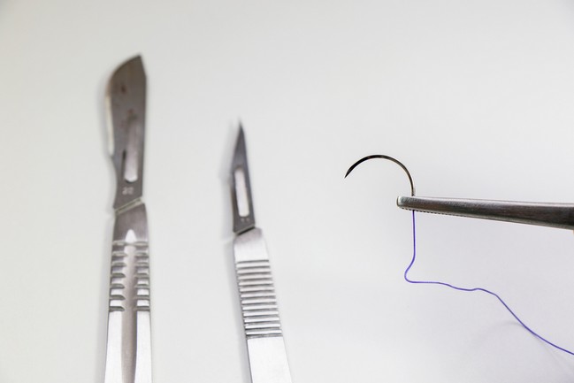 Absorbable Sutures