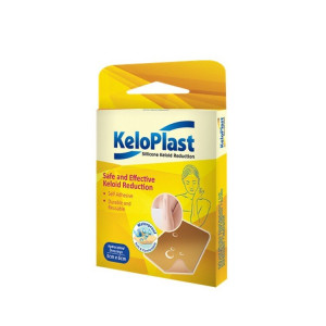 5 Obat Keloid yang Ampuh dan Praktis untuk Digunakan - Alodokter