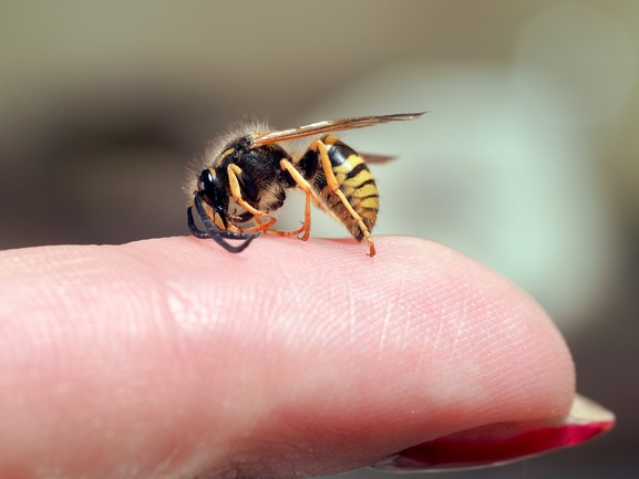 Treat Wasp Sting