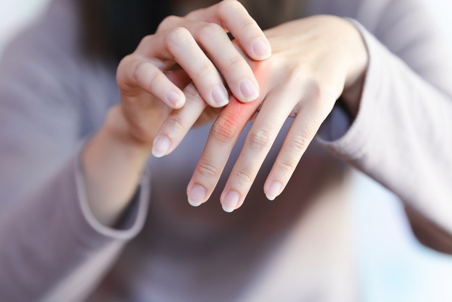 Rheumatoid Early Symptoms.