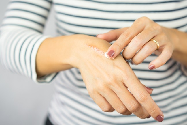 Topical Scar Medicines