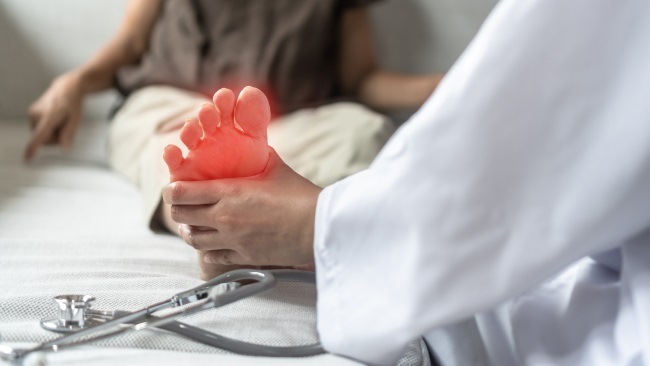 Sindrom Kaki Terbakar