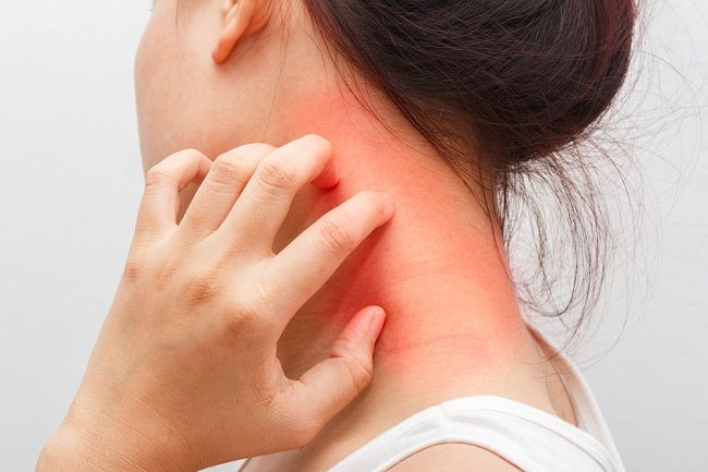 Gatal di Leher, Inilah 8 Penyebab dan Cara Ampuh Meredakannya - Alodokter