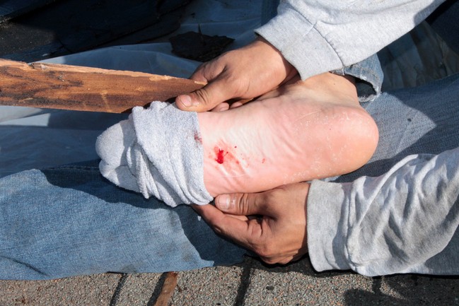 Types of Wounds that Need Tetanus Shot