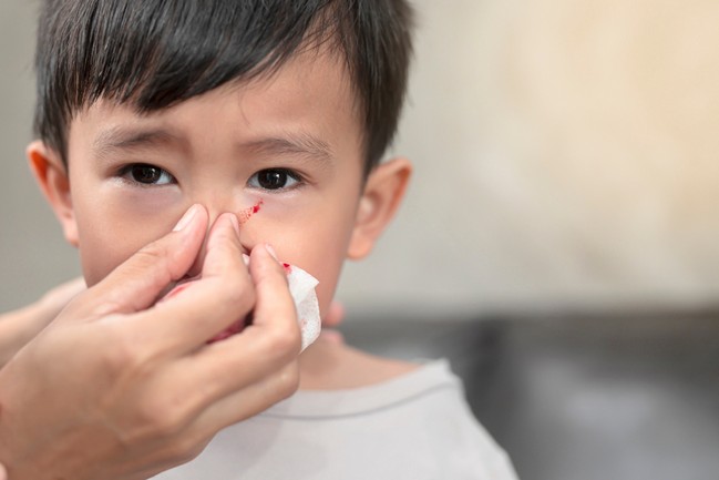 Nosebleed from One Nostril
