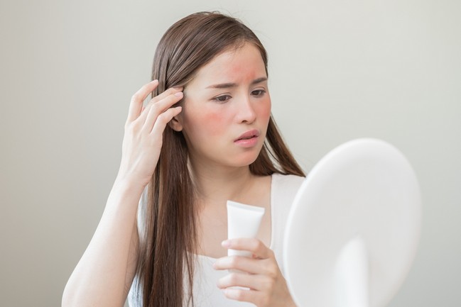 Ways to Treat Facial Allergic Rashes