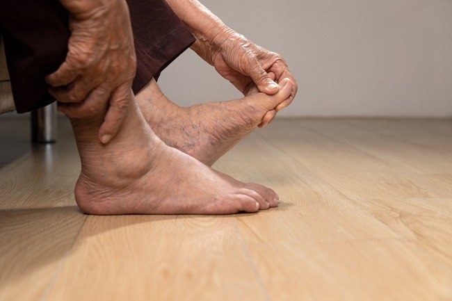 Characteristics of Recurring Ulcers and Effective Ways to Overcome Them