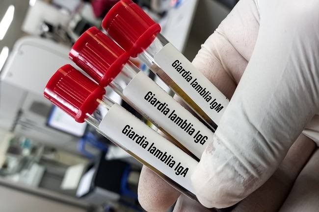 Giardia Lamblia, Parasit Penyebab Penyakit Giardiasis - Alodokter