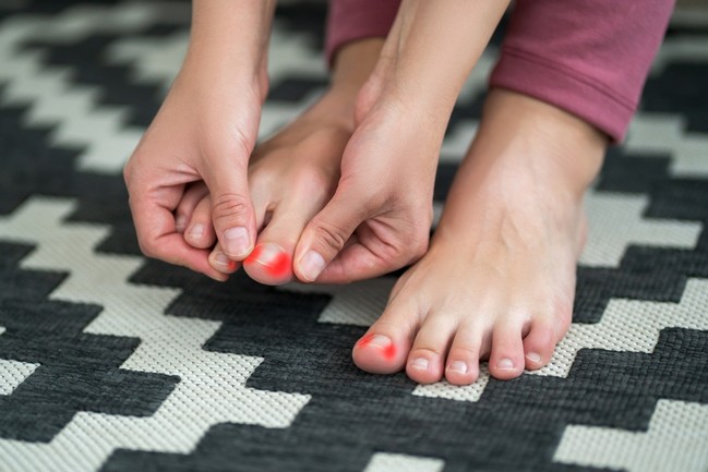 How to Cut Ingrown Toe nail.