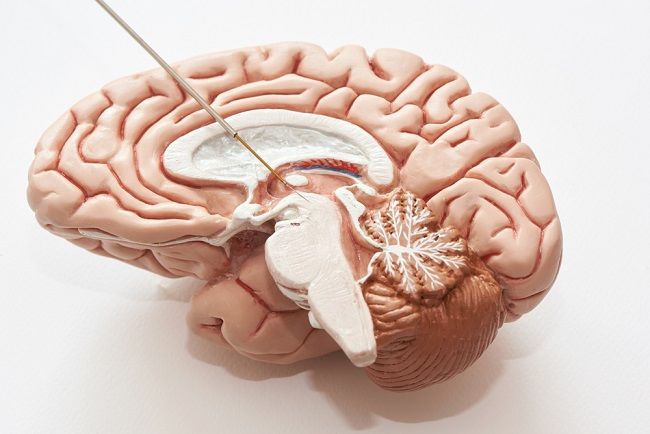 Deep Brain Stimulation, Ini yang Perlu Diketahui - Alodokter