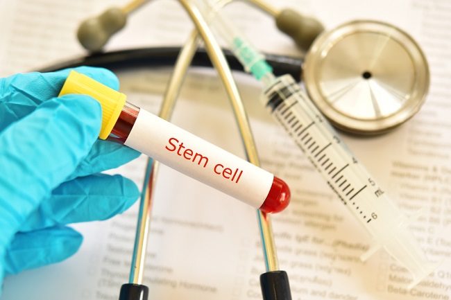 Terapi Stem Cell, Prosedur untuk Mengobati Kanker Darah - Alodokter