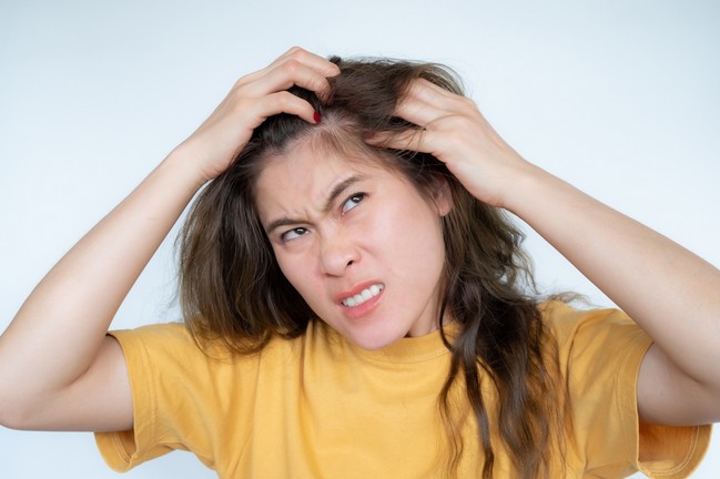 Itchy Scalp