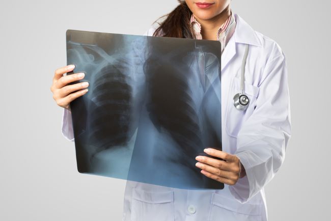 Rontgen Saat Hamil, Aman Nggak Ya? - Alodokter