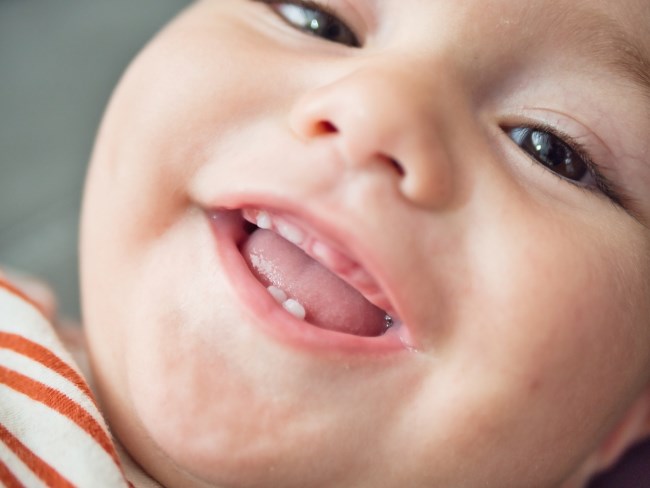 Pertumbuhan Gigi Bayi yang Tidak Normal, Ini Penyebab dan Penanganannya - Alodokter