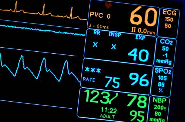 Cara Membaca Monitor ICU yang Perlu Diketahui - Alodokter