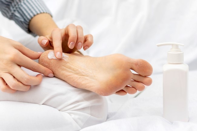 9 Obat Kaki Pecah-Pecah di Apotek yang Bagus - Alodokter